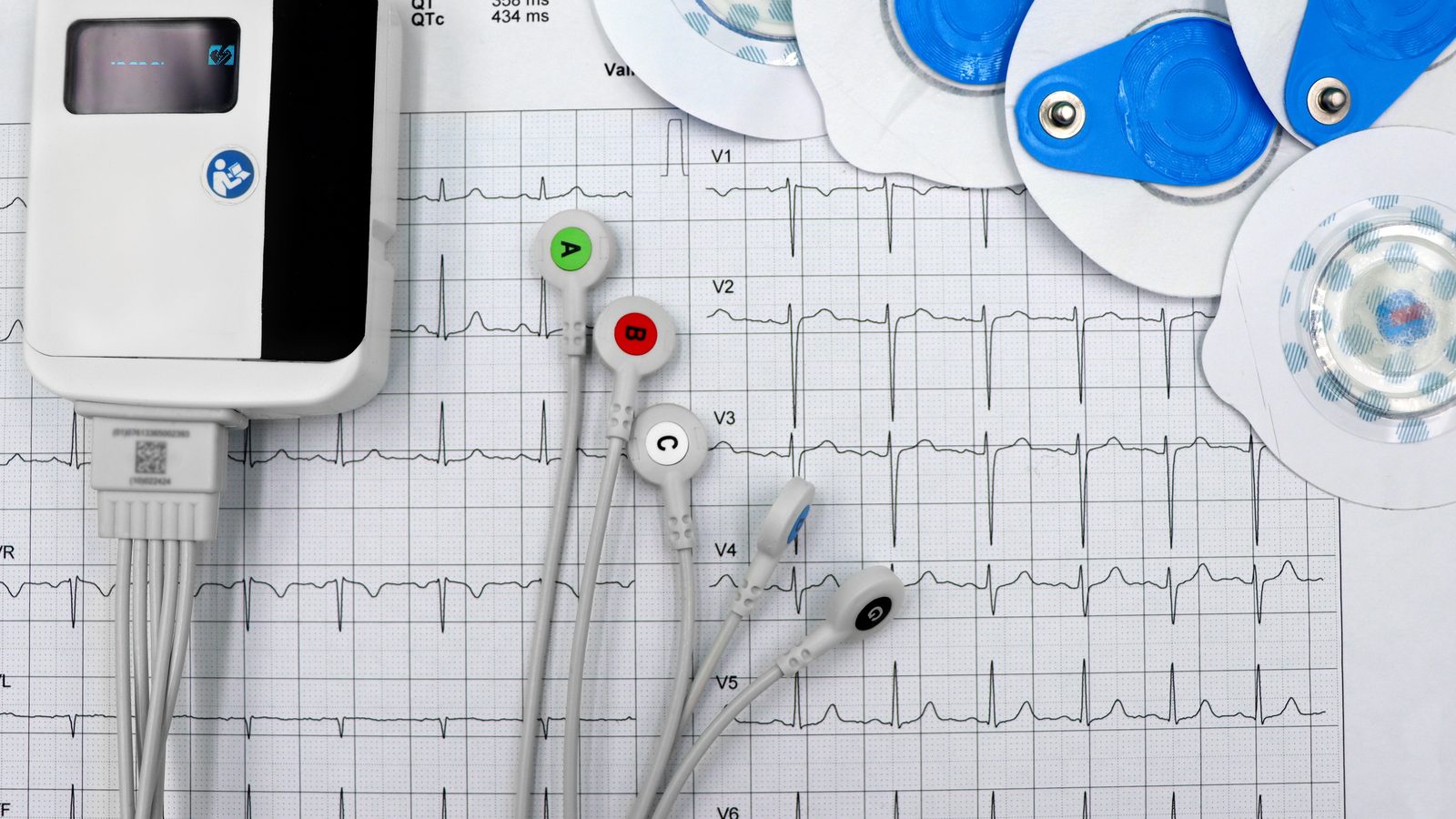 iRhythm says patient data was stolen from business apps, not clinical systems